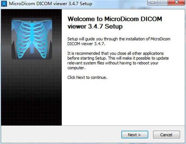 MicroDicom°氲װ̳1