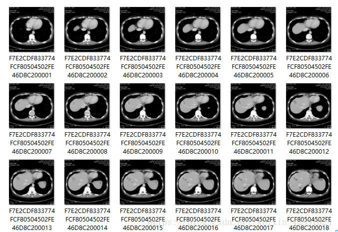 MicroDicom°ʹý̳6