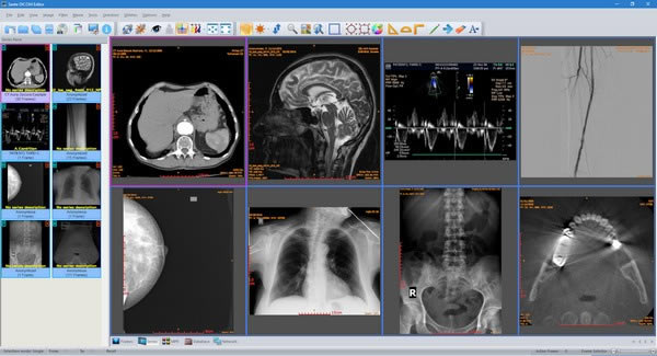 sante dicom editorر 